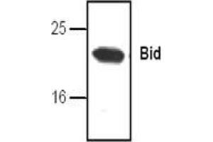 Image no. 1 for anti-BH3 Interacting Domain Death Agonist (BID) antibody (ABIN127033) (BID anticorps)