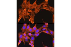 Immunofluorescence analysis of NIH-3T3 cells using PFKM Rabbit pAb (ABIN6132211, ABIN6145488, ABIN6145489 and ABIN6221141) at dilution of 1:100 (40x lens).