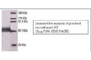 Image no. 1 for anti-Measles Virus Nucleoprotein (MV N) antibody (ABIN346974) (Measles Virus Nucleoprotein (MV N) anticorps)