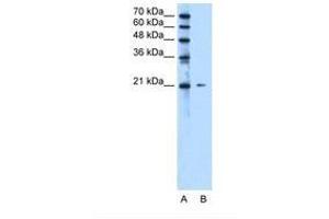 Image no. 1 for anti-Chromosome 20 Open Reading Frame 24 (C20ORF24) (N-Term) antibody (ABIN321585) (C20ORF24 anticorps  (N-Term))