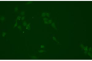 ABIN6266354 and ABIN6276702 staining HEPG2 cells by ICC/IF. (NQO1 anticorps  (C-Term))