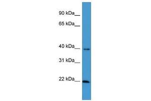 Western Blot showing EBAG9 antibody used at a concentration of 1-2 ug/ml to detect its target protein.