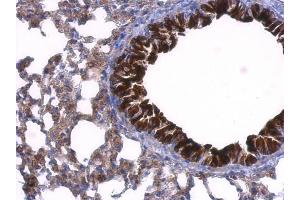 IHC-P Image GDI1 antibody detects GDI1 protein at cytosol on mouse lung by immunohistochemical analysis. (GDI1 anticorps)