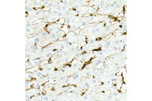 Immunohistochemistry of paraffin-embedded Human liver (positive control antibody staining, clone 55k-2) using Fascin/FSCN1 antibody (ABIN7267142) at dilution of 1:100 (40x lens).