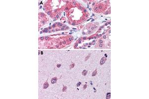 Immunohistochemical staining of formalin-fixed, paraffin-embedded human kidney (A) and human brain, cortex (B) tissue after heat-induced antigen retrieval. (IGSF8 anticorps  (Internal Region))