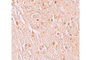 Immunohistochemistry (IHC) image for anti-Pigeon Homolog (PION) (C-Term) antibody (ABIN1030587) (GSAP anticorps  (C-Term))