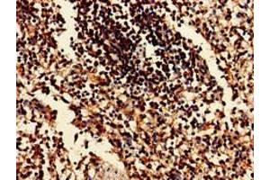 Immunohistochemistry of paraffin-embedded human spleen tissue using ABIN7152137 at dilution of 1:100 (EIF2AK1 anticorps  (AA 1-86))
