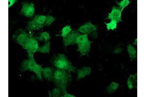 Image no. 2 for anti-Deoxythymidylate Kinase (Thymidylate Kinase) (DTYMK) antibody (ABIN1497923) (DTYMK anticorps)