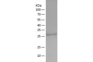 Western Blotting (WB) image for TP53 induced glycolysis regulatory phosphatase (TIGAR) (AA 2-270) protein (His tag) (ABIN7125420)
