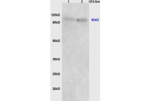 Lane 1: human colon carcinoma lysates Lane 2: mouse embryo lysates probed with Anti Beta-catenin/Catenin Beta Polyclonal Antibody, Unconjugated (ABIN738621) at 1:200 in 4C.