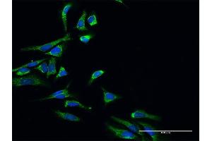 Immunofluorescence of purified MaxPab antibody to HSD17B10 on HeLa cell. (HSD17B10 anticorps  (AA 1-261))