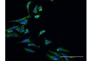 Immunofluorescence of purified MaxPab antibody to HSD17B10 on HeLa cell.