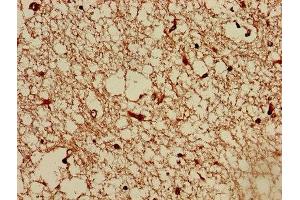 Immunohistochemistry of paraffin-embedded human brain tissue using ABIN7173087 at dilution of 1:100 (TMEM161B anticorps  (AA 1-487))