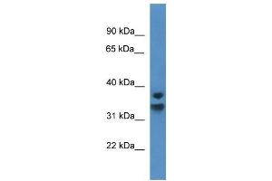 Western Blot showing NFKBID antibody used at a concentration of 1-2 ug/ml to detect its target protein.