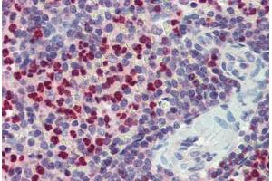 Spleen, Human: Formalin-Fixed, Paraffin-Embedded (FFPE)