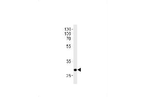 DANRE hoxc9a Antibody (C-term) Azb10016a western blot analysis in zebra fish brain tissue lysates (35 μg/lane).