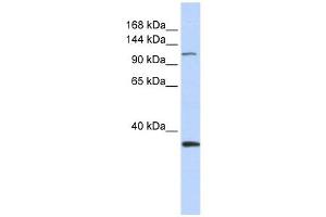 MCM2 antibody used at 1 ug/ml to detect target protein. (MCM2 anticorps  (Middle Region))