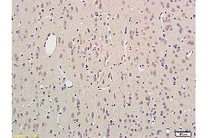 Formalin-fixed and paraffin embedded rat brain labeled with Anti SCN3B Polyclonal Antibody, Unconjugated (ABIN872574) followed by conjugation to the secondary antibody and DAB staining (SCN3B anticorps  (AA 21-120))