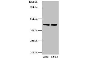 Western blot All lanes: LIAS antibody at 2 μg/mL Lane 1: MCF-7 whole cell lysate Lane 2: K562 whole cell lysate Secondary Goat polyclonal to rabbit IgG at 1/10000 dilution Predicted band size: 42, 37, 38 kDa Observed band size: 42 kDa (LIAS anticorps  (AA 28-372))