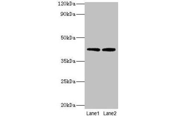 LIAS Antikörper  (AA 28-372)