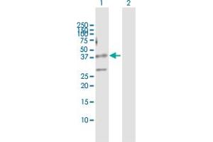 Western Blot analysis of ZFYVE19 expression in transfected 293T cell line by ZFYVE19 MaxPab polyclonal antibody. (ZFYVE19 anticorps  (AA 1-328))