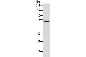 Gel: 8 % SDS-PAGE,Lysate: 40 μg,Primary antibody: ABIN7131472(TRIM14 Antibody) at dilution 1/800 dilution,Secondary antibody: Goat anti rabbit IgG at 1/8000 dilution,Exposure time: 3 seconds (TRIM14 anticorps)