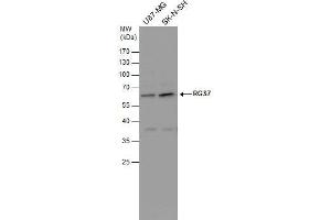 WB Image RGS7 antibody detects RGS7 protein by western blot analysis. (RGS7 anticorps)