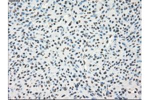 Immunohistochemical staining of paraffin-embedded Kidney tissue using anti-LTA4Hmouse monoclonal antibody. (LTA4H anticorps)