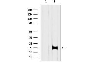 anti-Pre-mRNA Branch Site Protein p14 (SF3B14) (C-Term) antibody