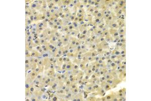 Immunohistochemistry of paraffin-embedded mouse pancreas using DKC1 Antibody (ABIN5970956) at dilution of 1/100 (40x lens). (DKC1 anticorps)