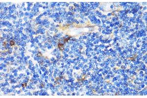 Immunohistochemistry of paraffin-embedded Human tonsil using PTCH1 Polyclonal Antibody at dilution of 1:100 (40x lens).