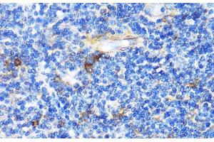 Immunohistochemistry of paraffin-embedded Human tonsil using PTCH1 Polyclonal Antibody at dilution of 1:100 (40x lens). (Patched 1 anticorps)