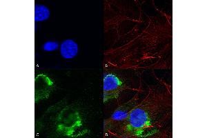 Immunocytochemistry/Immunofluorescence analysis using Mouse Anti-GFAP R416WT Monoclonal Antibody, Clone S206B-9 (ABIN1740974). (GFAP anticorps  (AA 411-422) (Biotin))