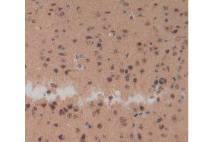 Used in DAB staining on fromalin fixed paraffin-embedded Brain tissue (NPS anticorps  (AA 26-89))