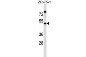 Western Blotting (WB) image for anti-Essential Meiotic Endonuclease 1 Homolog 2 (EME2) antibody (ABIN2998688) (EME2 anticorps)