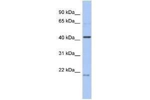 WB Suggested Anti-FAM98B Antibody Titration: 0. (FAM98B anticorps  (N-Term))
