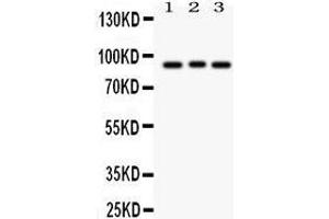 Western Blotting (WB) image for anti-Sema Domain, Immunoglobulin Domain (Ig), Short Basic Domain, Secreted, (Semaphorin) 3A (SEMA3A) (AA 550-771) antibody (ABIN3043328) (SEMA3A anticorps  (AA 550-771))