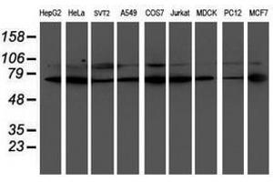 Image no. 8 for anti-LIM Domain Kinase 1 (LIMK1) antibody (ABIN1499147)
