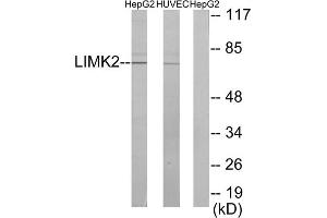 Western blot analysis of extracts from HepG2 cells and HUVEC cells, using LIMK2 antibody. (LIMK2 anticorps  (Internal Region))