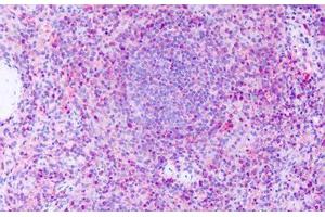Anti-GPR63 antibody IHC staining of human spleen.
