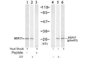 Image no. 2 for anti-Heat Shock 27kDa Protein 1 (HSPB1) (pSer82) antibody (ABIN197004) (HSP27 anticorps  (pSer82))