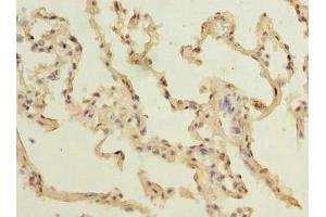 Immunohistochemistry of paraffin-embedded human lung tissue using ABIN7172926 at dilution of 1:100 (TM4SF1 anticorps  (AA 115-161))