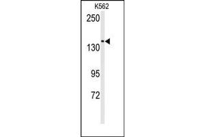 Image no. 1 for anti-Transient Receptor Potential Cation Channel, Subfamily M, Member 7 (TRPM7) (N-Term) antibody (ABIN360498) (TRPM7 anticorps  (N-Term))