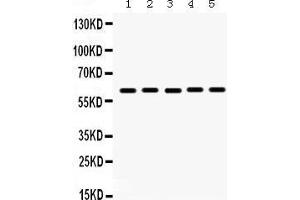 Western Blotting (WB) image for anti-Monoamine Oxidase A (MAOA) (AA 457-493), (C-Term) antibody (ABIN3043872) (Monoamine Oxidase A anticorps  (C-Term))
