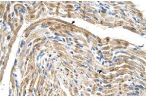 Immunohistochemical staining (Formalin-fixed paraffin-embedded sections) of human muscle with FADS1 polyclonal antibody  at 4-8 ug/mL working concentration. (FADS1 anticorps  (C-Term))