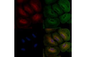 ABIN6262941 and ABIN6276549 staining  cells by IF/ICC.