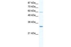 Western Blotting (WB) image for anti-DEAD (Asp-Glu-Ala-Asp) Box Polypeptide 31 (DDX31) antibody (ABIN2461359) (DDX31 anticorps)