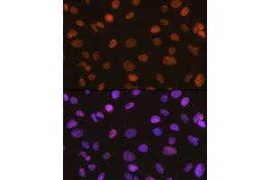 Immunofluorescence analysis of U-2 OS cells using SM/SM/SNF2H Rabbit mAb (ABIN7270656) at dilution of 1:100 (40x lens).