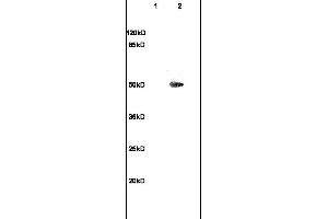 Formalin-fixed and paraffin embedded rat brain labeled with Anti-TUBB3 Polyclonal Antibody, Unconjugated (ABIN706736) at 1:200 followed by conjugation to the secondary antibody and DAB staining