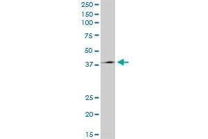TCF2 monoclonal antibody (M06), clone 4E9.